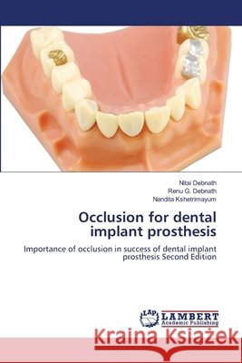 Occlusion for dental implant prosthesis Nitai Debnath Renu G. Debnath Nandita Kshetrimayum 9786209902253