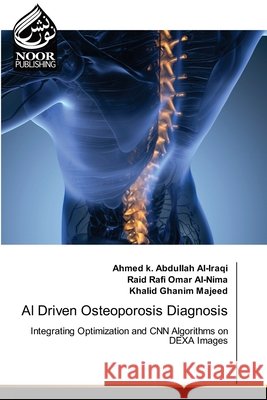 AI Driven Osteoporosis Diagnosis Ahmed K. Abdullah Al-Iraqi Raid Rafi Omar Al-Nima Khalid Ghanim Majeed 9786209917059
