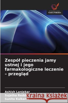 Zesp?l pieczenia jamy ustnej i jego farmakologiczne leczenie - przegląd Ashish Lanjekar Sujatha Reddy Sunita Kulkarni 9786209927713