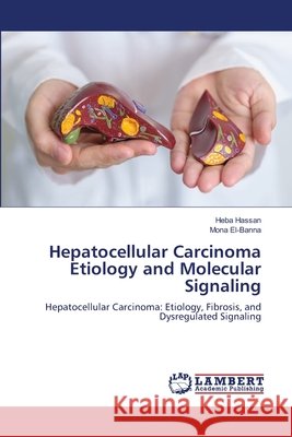 Hepatocellular Carcinoma Etiology and Molecular Signaling Hassan, Heba, El-Banna, Mona 9786209954184 LAP Lambert Academic Publishing