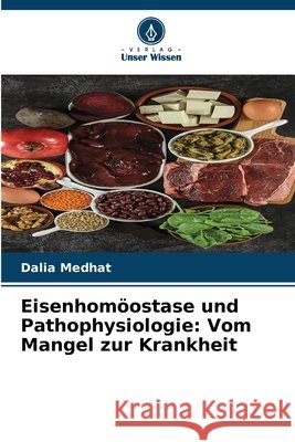 Eisenhomöostase und Pathophysiologie: Vom Mangel zur Krankheit Medhat, Dalia 9786209967221
