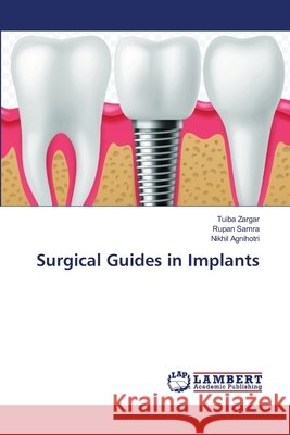 Surgical Guides in Implants Tuiba Zargar Rupan Samra Nikhil Agnihotri 9786209998935