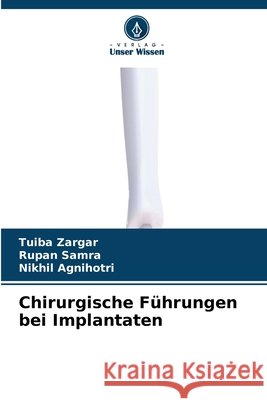 Chirurgische F?hrungen bei Implantaten Tuiba Zargar Rupan Samra Nikhil Agnihotri 9786630011111