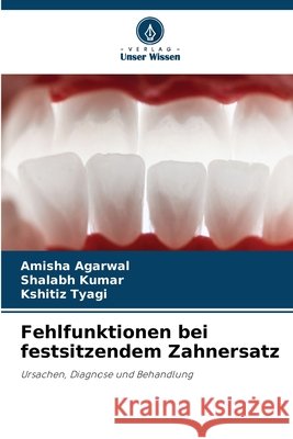Fehlfunktionen bei festsitzendem Zahnersatz Amisha Agarwal Shalabh Kumar Kshitiz Tyagi 9786630021547