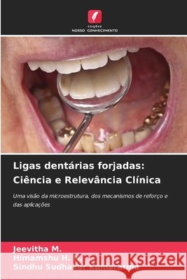 Ligas dent?rias forjadas: Ci?ncia e Relev?ncia Cl?nica Jeevitha M Himamshu H. N. Sindhu Sudhakar Kumararma 9786630046861