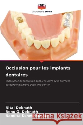 Occlusion pour les implants dentaires Nitai Debnath Renu G. Debnath Nandita Kshetrimayum 9786630068542