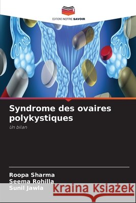 Syndrome des ovaires polykystiques Roopa Sharma Seema Rohilla Sunil Jawla 9786630072600 Editions Notre Savoir