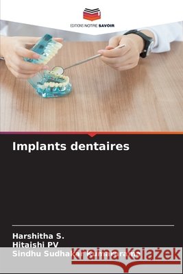 Implants dentaires Harshitha S Hitaishi Pv Sindhu Sudhakar Kumararama 9786630076622