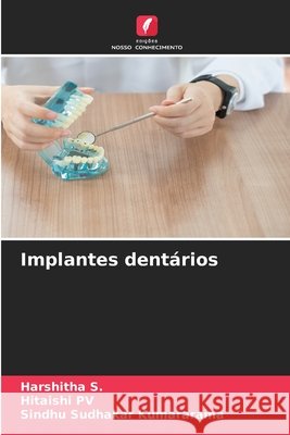 Implantes dent?rios Harshitha S Hitaishi Pv Sindhu Sudhakar Kumararama 9786630081749