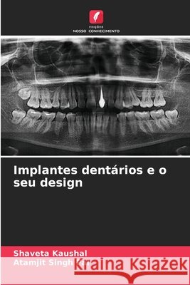 Implantes dent?rios e o seu design Shaveta Kaushal Atamjit Singh Pal 9786630106534