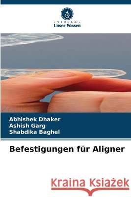 Befestigungen f?r Aligner Abhishek Dhaker Ashish Garg Shabdika Baghel 9786630112061