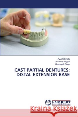 Cast Partial Dentures: Distal Extension Base Ayushi Singla Archana Nagpal Geetanjali Singh 9786630113600 LAP Lambert Academic Publishing