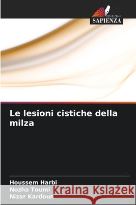 Le lesioni cistiche della milza Houssem Harbi Nozha Toumi Nizar Kardoun 9786630129656