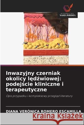 Inwazyjny czerniak okolicy lędźwiowej: podejście kliniczne i terapeutyczne Romero Escamilla, Diana Verónica 9786630138641