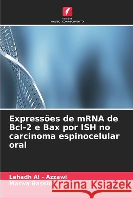 Expressões de mRNA de Bcl-2 e Bax por ISH no carcinoma espinocelular oral Al -. Azzawi, Lehadh, Bassim, Marwa 9786630151633