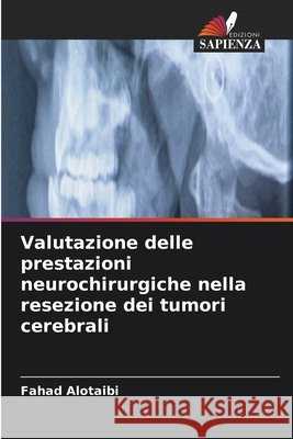 Valutazione delle prestazioni neurochirurgiche nella resezione dei tumori cerebrali Fahad Alotaibi 9786630193572 Edizioni Sapienza