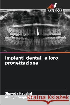 Impianti dentali e loro progettazione Shaveta Kaushal Atamjit Singh Pal 9786630196122