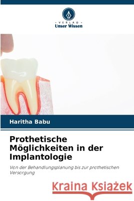 Prothetische M?glichkeiten in der Implantologie Haritha Babu 9786630211047