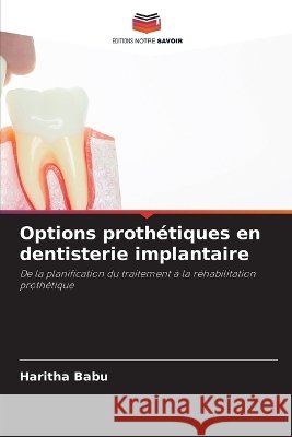 Options proth?tiques en dentisterie implantaire Haritha Babu 9786630216165