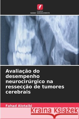 Avalia??o do desempenho neurocir?rgico na ressec??o de tumores cerebrais Fahad Alotaibi 9786630237337