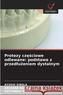 Protezy częściowe odlewane: podstawa z przedlużeniem dystalnym Ayushi Singla Archana Nagpal Geetanjali Singh 9786630252040 Wydawnictwo Nasza Wiedza