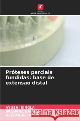 Pr?teses parciais fundidas: base de extens?o distal Ayushi Singla Archana Nagpal Geetanjali Singh 9786630254600 Edicoes Nosso Conhecimento