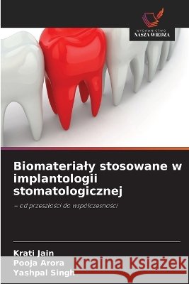 Biomaterialy stosowane w implantologii stomatologicznej Krati Jain Pooja Arora Yashpal Singh 9786630255232