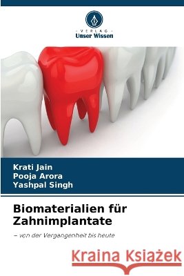 Biomaterialien f?r Zahnimplantate Krati Jain Pooja Arora Yashpal Singh 9786630257793