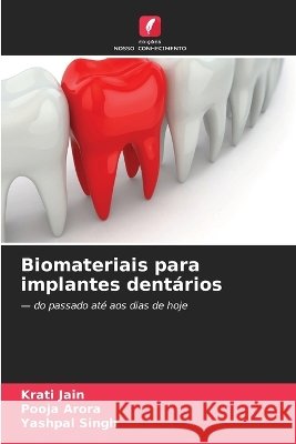 Biomateriais para implantes dent?rios Krati Jain Pooja Arora Yashpal Singh 9786630268034