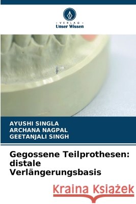 Gegossene Teilprothesen: distale Verl?ngerungsbasis Ayushi Singla Archana Nagpal Geetanjali Singh 9786630326277