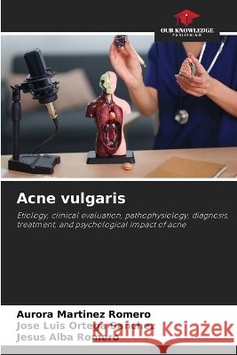 Acne vulgaris Aurora Mart?nez Romero Jos? Luis Ortega Sanchez Jesus Alba Romero 9786630350999