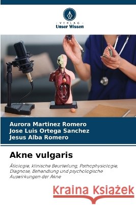 Akne vulgaris Aurora Mart?nez Romero Jos? Luis Ortega Sanchez Jesus Alba Romero 9786630353556