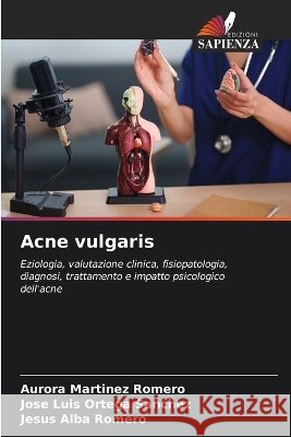 Acne vulgaris Aurora Mart?nez Romero Jos? Luis Ortega Sanchez Jesus Alba Romero 9786630363791