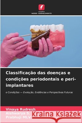 Classificação das doenças e condições periodontais e peri-implantares Rudresh, Vinaya, S, Aishwarya, MLV, Prabhuji 9786630393446