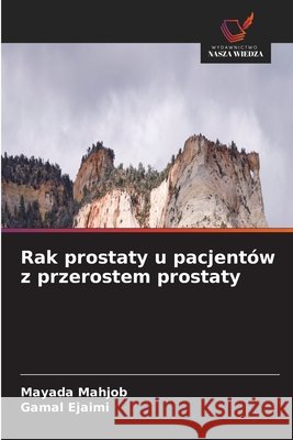 Rak prostaty u pacjent?w z przerostem prostaty Mayada Mahjob Gamal Ejaimi 9786630420791