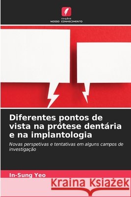 Diferentes pontos de vista na prótese dentária e na implantologia Yeo, In-Sung 9786630449501