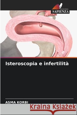 Isteroscopia e infertilità Korbi, Asma 9786630453720