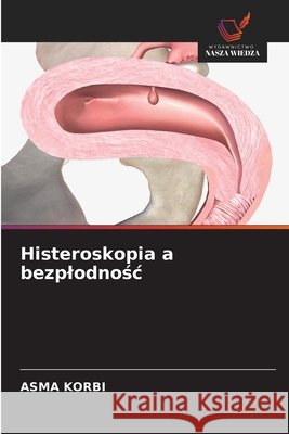 Histeroskopia a bezplodnośc Korbi, Asma 9786630456288