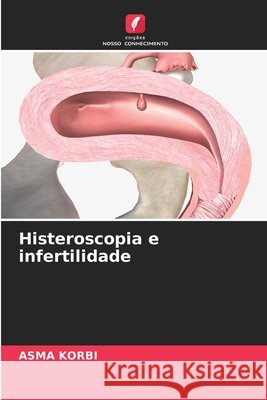 Histeroscopia e infertilidade Korbi, Asma 9786630458848
