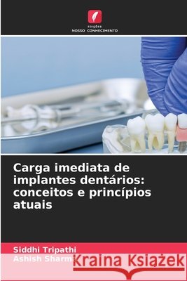 Carga imediata de implantes dentários: conceitos e princípios atuais Tripathi, Siddhi, Sharma, Ashish 9786630474183