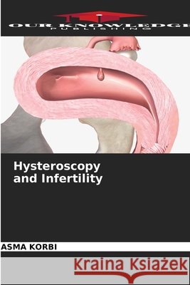 Hysteroscopy and Infertility Korbi, Asma 9786630499797