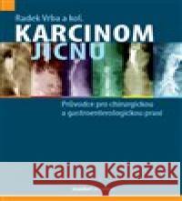 Karcinom jícnu Radek Vrba 9788073456955