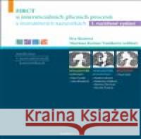 HRCT u intersticiálních plicních procesů v instruktivních kazuistikách Martina Koziar Vašáková 9788073457129