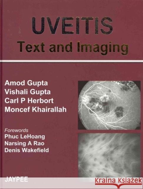 UVEITIS Text and Imaging Amod Gupta 9788184484915