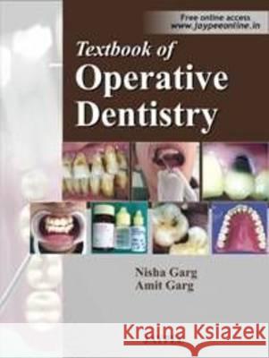 Textbook of Operative Dentistry  Garg, Nisha|||Garg, Amit 9788184487756 