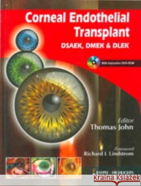 Corneal Endothelial Transplant DSEAK, DMEK and DLEK Thomas, John 9788184487923 