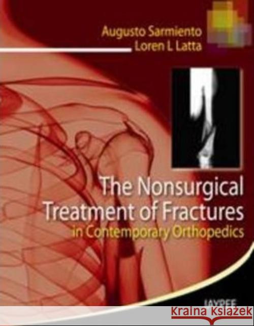 The Nonsurgical Treatment of Fractures in Contemporary Orthopedics Augusto Sarmiento, Loren Latta 9788184489071 JP Medical Publishers (ML)