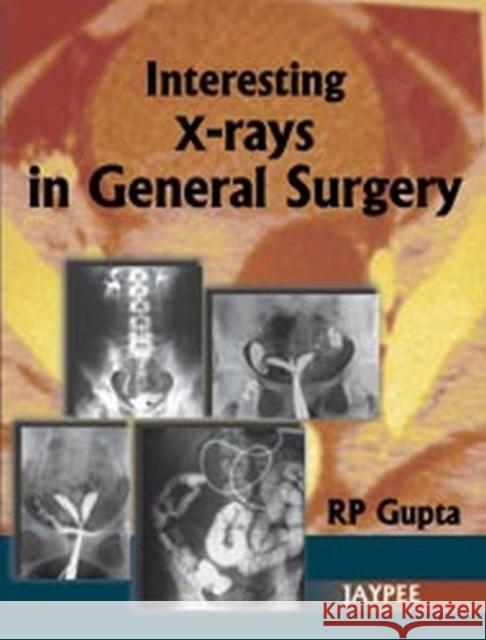 Interesting X-Rays in General Surgery Rp Gupta 9788184489200 Jaypee Brothers, Medical Publishers Pvt. Ltd.