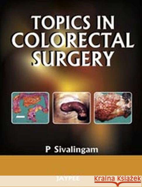 Topics in Colorectal Surgery P. Sivalingam   9788184489309 Jaypee Brothers Medical Publishers