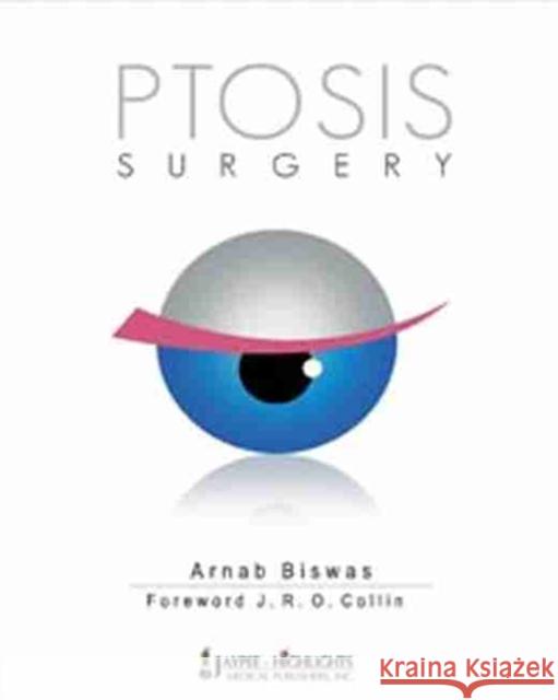 Ptosis Surgery Biswas, Arnab 9788184489637 